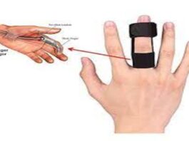 Finger Splint | Medical Conditions That Require Splints