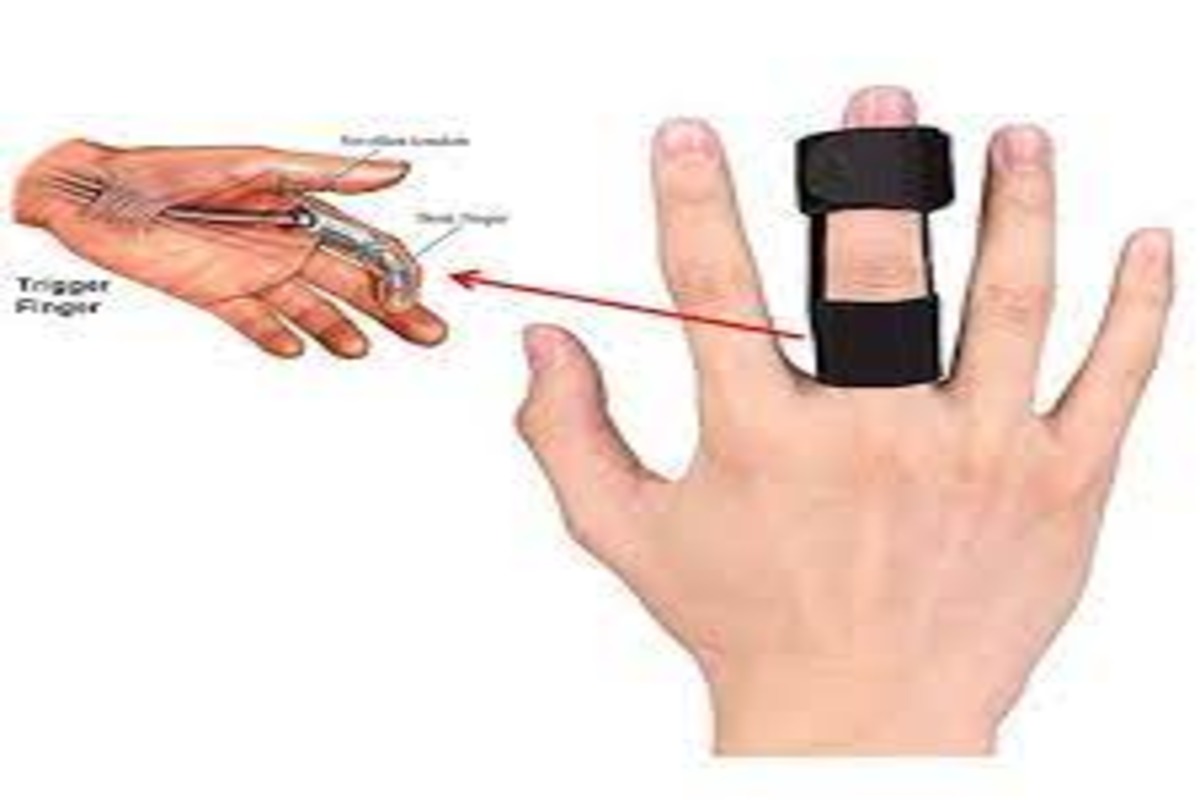 Finger Splint | Medical Conditions That Require Splints
