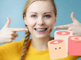 Braces| Can You Eat Marshmallows With Braces?