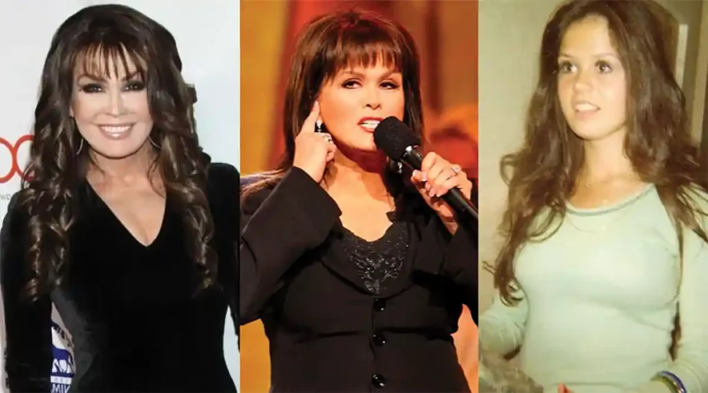 Marie Osmond Plastic Surgery