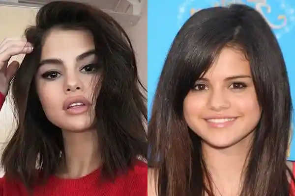 Selena Gomez Plastic Surgery